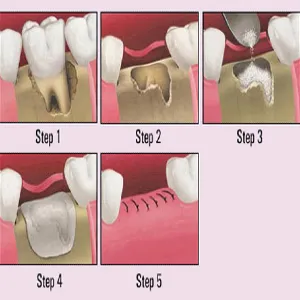 Dental Implants Professionals-http://www.dentalimplantscost.com.au