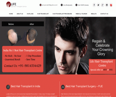 Hair transplant in India