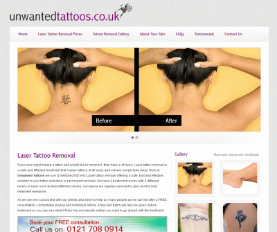 Laser Tattoo Removal Clinic  Tattoo Removal In United Kingdom