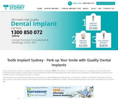 Tooth Implant Sydney Natural-looking Teeth Artificial Tooth Australia