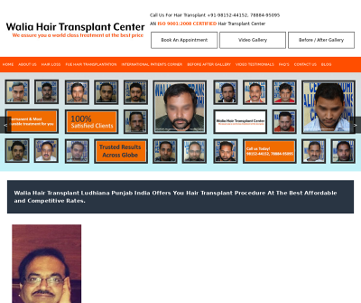 Walia Hair Transplant Center | Ludhiana