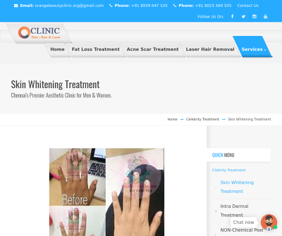Skin Whitening Treatment