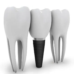Implant crown