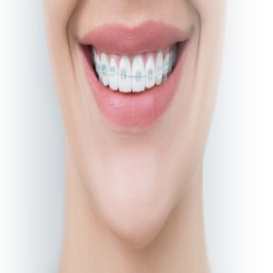 Westpoint Dental Clinic-http://www.westpointdental.com.au